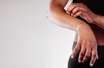 A Daily Pill for Chronic Hives Just Got a Major Expansion